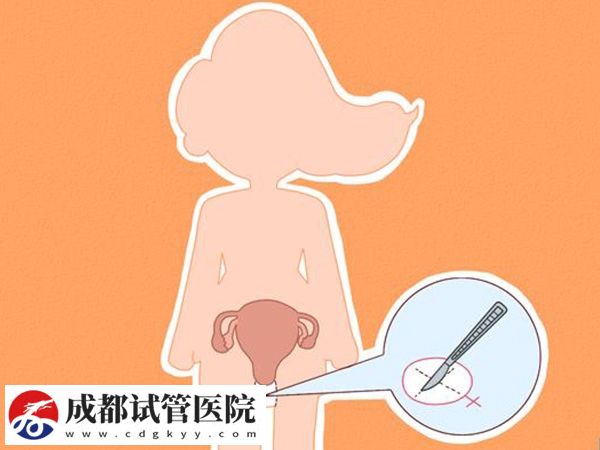 什么是始基子宮？始基子宮的治療方法有哪些？(圖5)